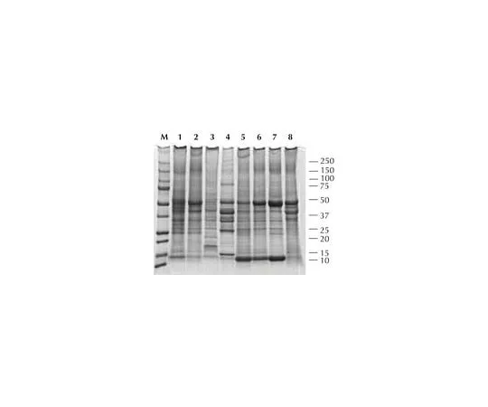 62-8534-55 Total Protein Extraction Kit; 1 kit 2140