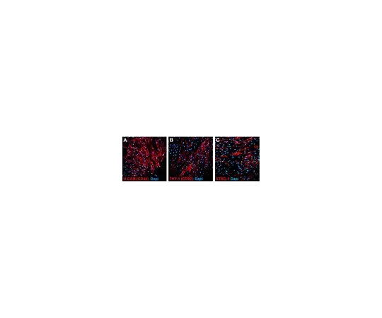 62-8531-78 Human mesenchymal stem cells (bone marrow derived) SCC034