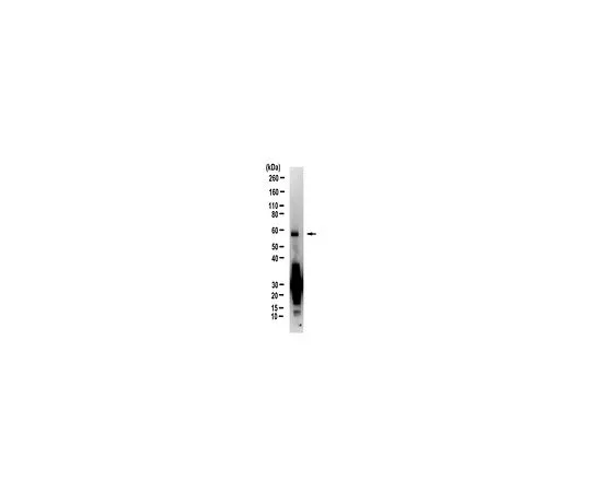 62-8520-08 Anti-C9ORF72/C9RANT (poly-GA) Antibody, clone 5E9 Antibody, Alexa Fluor(R) 488 Conjugate MABN889-AF488