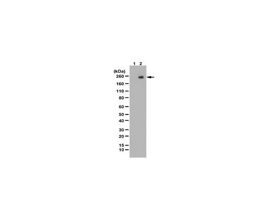 62-8470-72 Anti-phospho-KDR/FLK-1/VEGFR2 (Tyr1059) ABS553
