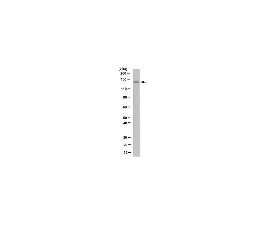 62-8502-17 Anti-FANCJ/BACH1, clone 2G7 MABC538