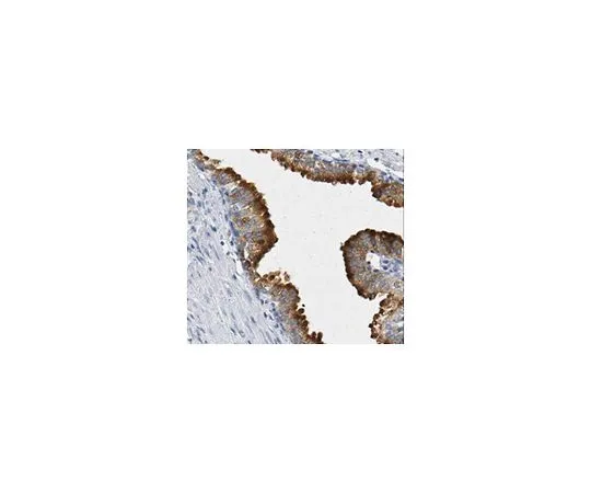 62-8517-38 Anti-Prostatic acid phosphatase/TMPAP, clone 3G10.1 MABN318