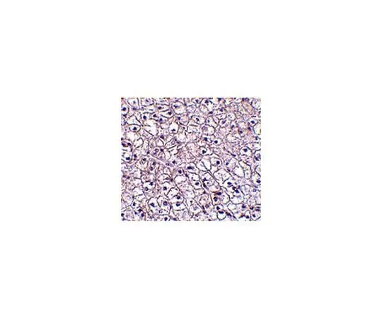 62-8473-69 Anti-TSLP receptor ABT334