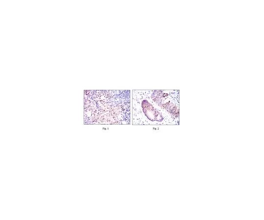 62-8519-23 Anti-ASS1, clone 2C10 MABN704