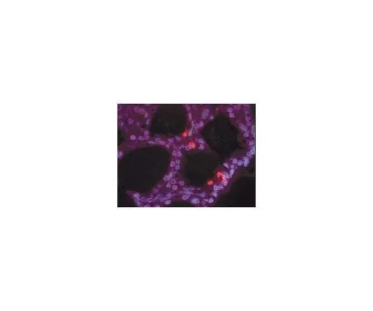 62-8531-20 ApopTag(R) Positive Control Slides, rat mammary gland 4d post weaning; 5 ea S7115