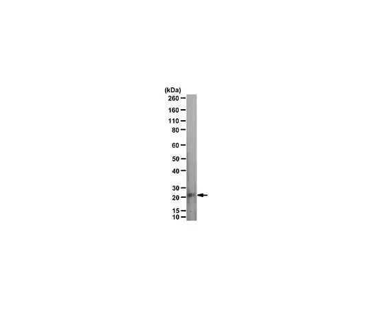 62-8468-60 Anti-p75NTR Antibody, ICD ABN1655