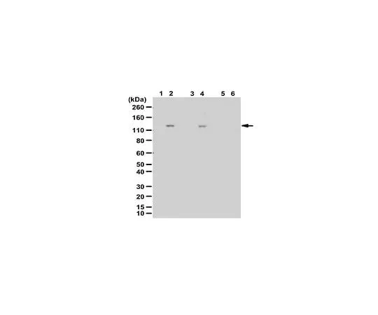 62-8469-67 Anti-phospho-DBC1 (Thr454) ABS218