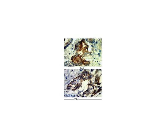62-8525-36 Anti-Nectin-4/PVRL4, clone N4.61; 100 μg MABT64