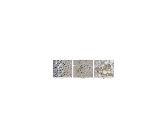 62-8519-96 Anti-Cav1.2 alpha1c, clone 8F9.1 MABN863