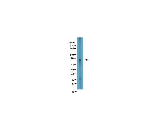 62-8469-18 Anti-CPT1A ABS65