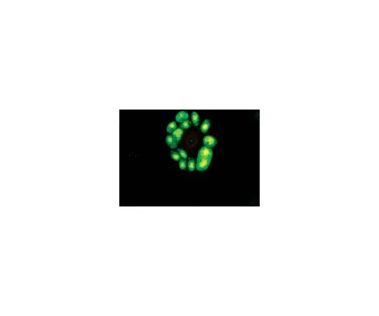 62-8498-74 Anti-Cytomegalovirus, early, clone 5A8.2; 100 μg MAB8140