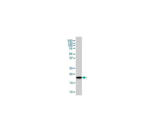 62-8534-18 Anti-SKP1A Mo*** mAb (1H8) ST1709-100UG