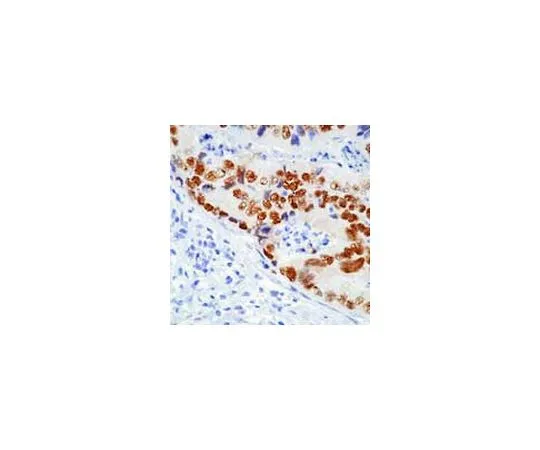 62-8529-37 Anti-p53 (Ab-12) (Pantropic) Mo*** mAb (DO-7) OP140-100UG