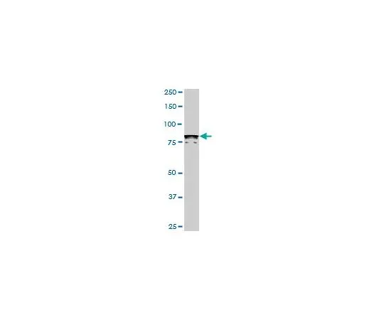 62-8533-98 Anti-DYRK1A Mo*** mAb (7D10) ST1650-100UG