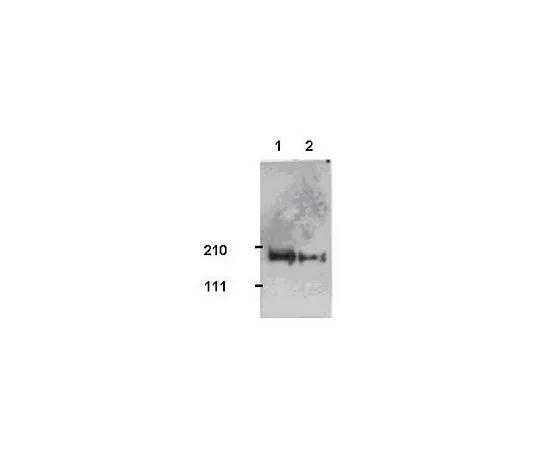 62-8533-42 Anti-Tiam1 Rabbit pAb ST1070-50UG