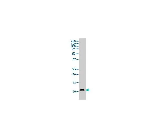 62-8478-82 Anti-S100A7 Mo*** mAb (1A4) CB1036-100UG