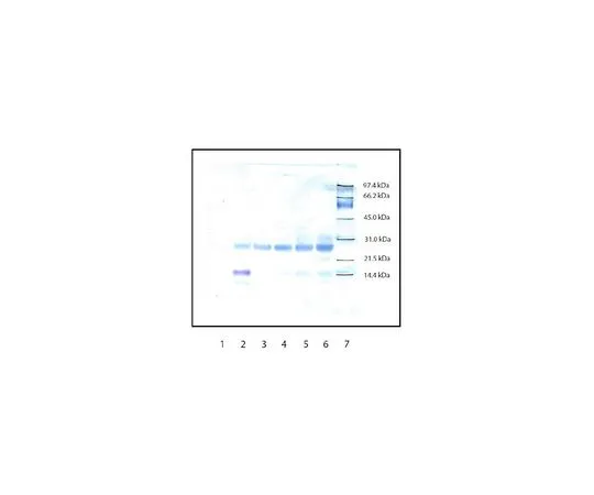 62-8442-19 Anti-Trypsin Rabbit pAb 650297-1ML