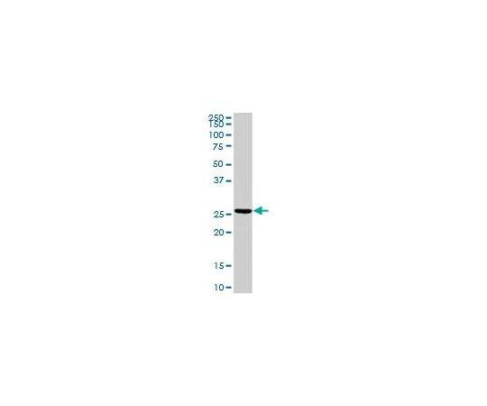 62-8478-89 Anti-TNNI2 Rabbit pAb CB1048-100UG