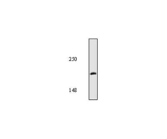 62-8528-32 Anti-AnkyrinG Mo*** mAb (463) NB20-100UG