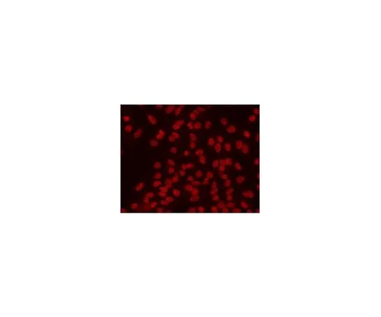 62-8528-15 Anti-2,2,7-Trimethylguanosine Mo*** mAb (K121) NA02-100UG