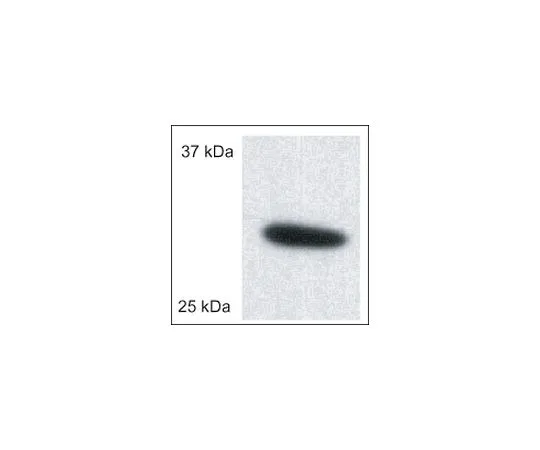 62-8529-97 Anti-Porin (Ab-5) (185-197) Rabbit pAb PC548-50UG