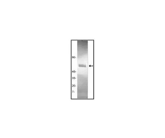62-8485-81 Anti-Tissue Plasminogen Activator (Ab-1) Mo*** mAb (GMA-043) GF53-100UG