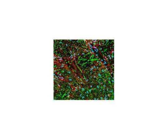 62-8528-43 PhosphoDetect(TM) Anti-Neurofilament-H Mo*** mAb (SMI-31) NE1022-100UL