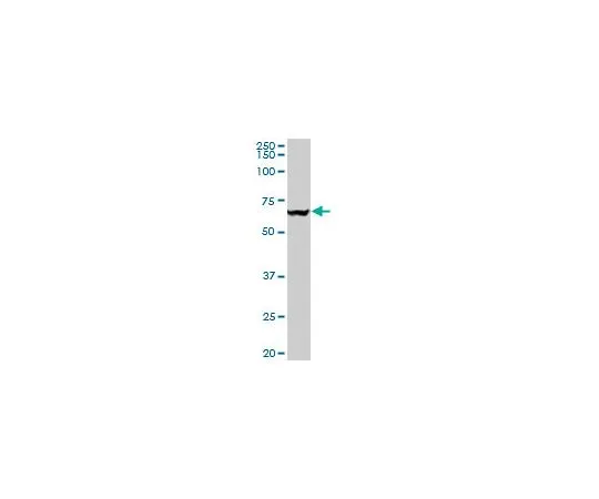 62-8533-67 Anti-VCP Mo*** mAb (4A8) ST1553-100UG