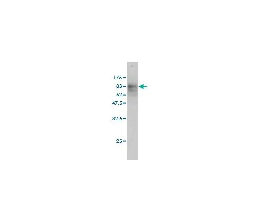 62-8481-36 Anti-SQSTM1 Mo*** mAb (2C11) DR1057-100UG