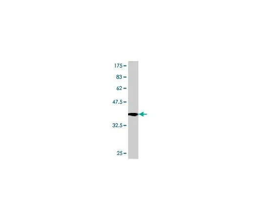 62-8534-11 Anti-TRPA1 Mo*** mAb (6G8) ST1685-100UG