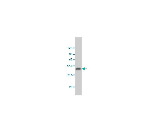 62-8534-02 Anti-BCL9 Mo*** mAb (2D4) ST1662-100UG