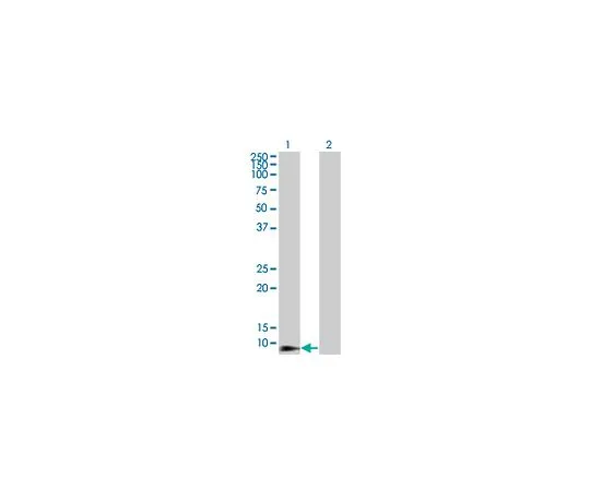 62-8533-70 Anti-DEFB4 Mo*** mAb (4C4) ST1568-100UG