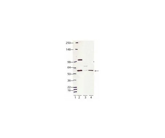 62-8411-33 Anti-Calreticulin (405-417) Rabbit pAb 208910-50UL