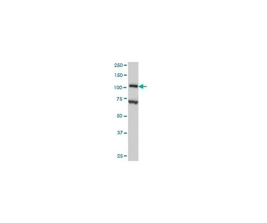 62-8534-03 Anti-DPYD Mo*** mAb (7D4) ST1672-100UG