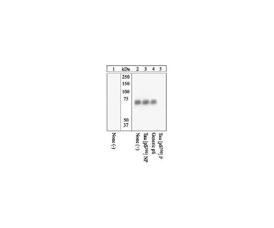 62-8440-13 PhosphoDetect(TM) Anti-Tau (pSer396) Rabbit pAb 577815-10T