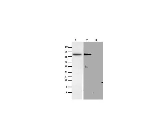 62-8488-04 Anti-Matriptase/MT-SP1 Rabbit pAb IM1014-50UG