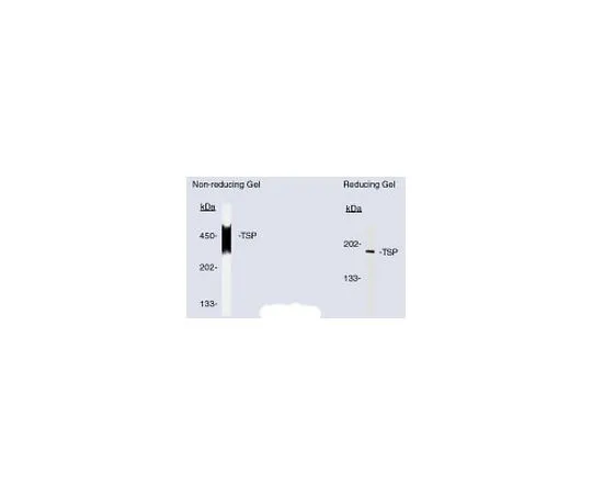 62-8478-43 Anti-Thrombospondin (Ab-3) Mo*** mAb (A6.1) BA24-100UG