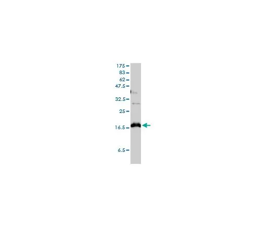 62-8478-87 Anti-CLDN1 Mo*** mAb (1C5-D9) CB1046-100UG