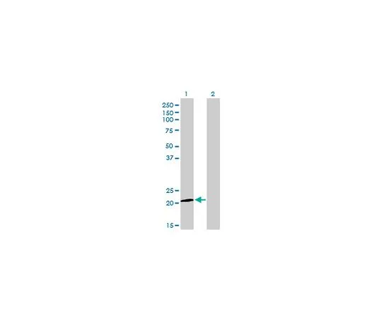 62-8481-43 Anti-ATF3 Mo*** mAb (6B8) DR1086-100UG
