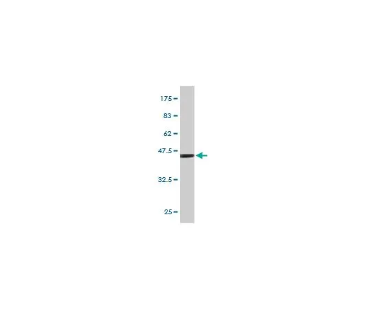 62-8533-86 Anti-FGF21 Mo*** mAb (2F11) ST1615-100UG
