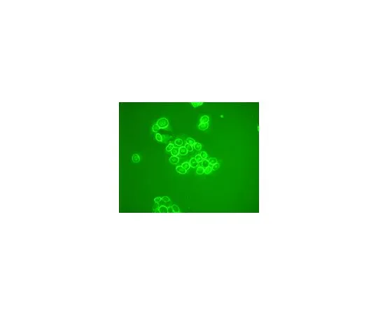 62-8529-40 Anti-MDM2 (Ab-5) Mo*** mAb (4B2C1.11) OP145-100UG