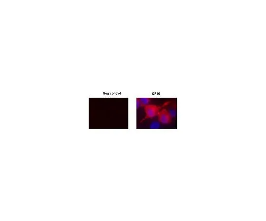 62-8528-87 Anti-c-ErbB2/c-Neu (Ab-4) Mo*** mAb (7.16.4) OP16-100UG