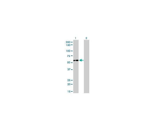 62-8533-73 Anti-IMPDH2 Mo*** mAb (1E12-B6) ST1578-100UG