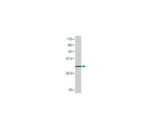 62-8533-68 Anti-ALOX12 Mo*** mAb (2D10) ST1558-100UG