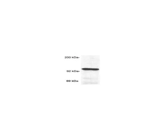 62-8487-40 Anti-Glucocorticoid Receptor (Ab-2) Mo*** mAb (BuGR2) GR32L-100UG