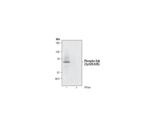 62-8530-33 PhosphoDetect(TM) Anti-Syk (pTyr525/526) Rabbit pAb PK1010-50UL