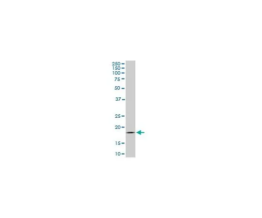 62-8534-16 Anti-TOMM22 Mo*** mAb (4G4) ST1704-100UG
