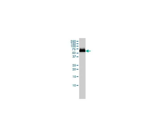 62-8477-57 Anti-GBA Mo*** mAb (2E2) AP1140-100UG