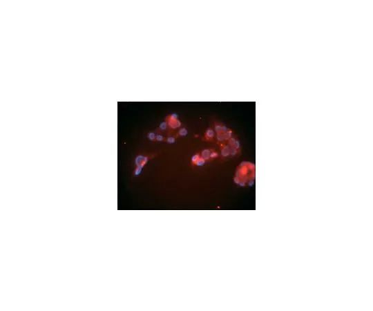 62-8488-19 Anti-LDL Receptor Mo*** mAb (15C8) LP02-100UG