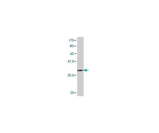 62-8477-69 Anti-TLR4 Mo*** mAb (1H7) AP1179-100UG